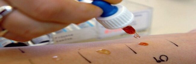 Tests d'allergie et vaccination