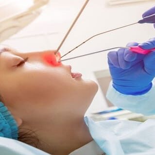 Chirurgie endoscopique des sinus