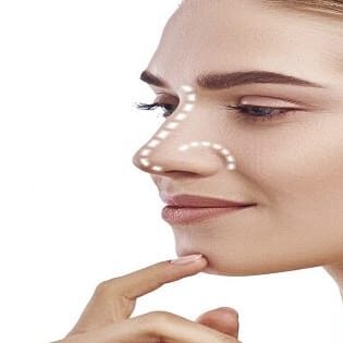 Functional Nose Surgery Functional Nose Surgery