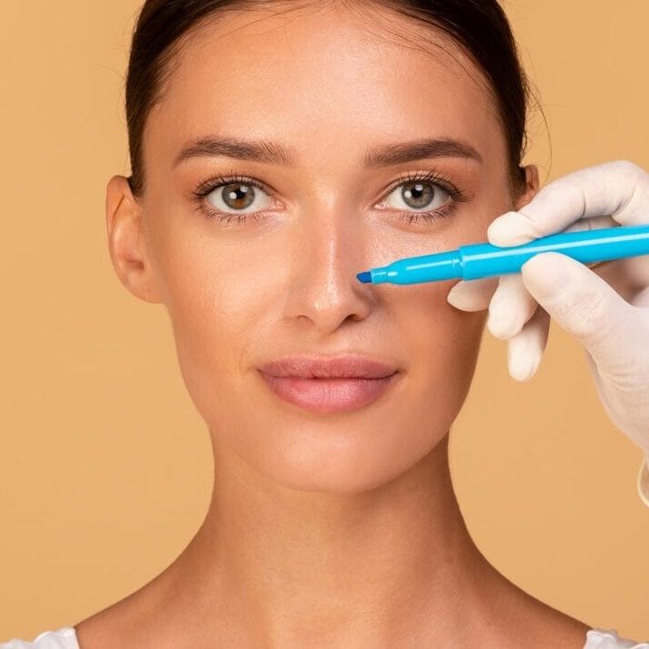 Revision Rhinoplasty Revision Rhinoplasty