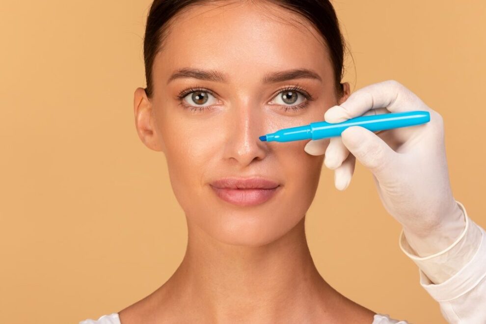 Rhinoplastie de révision